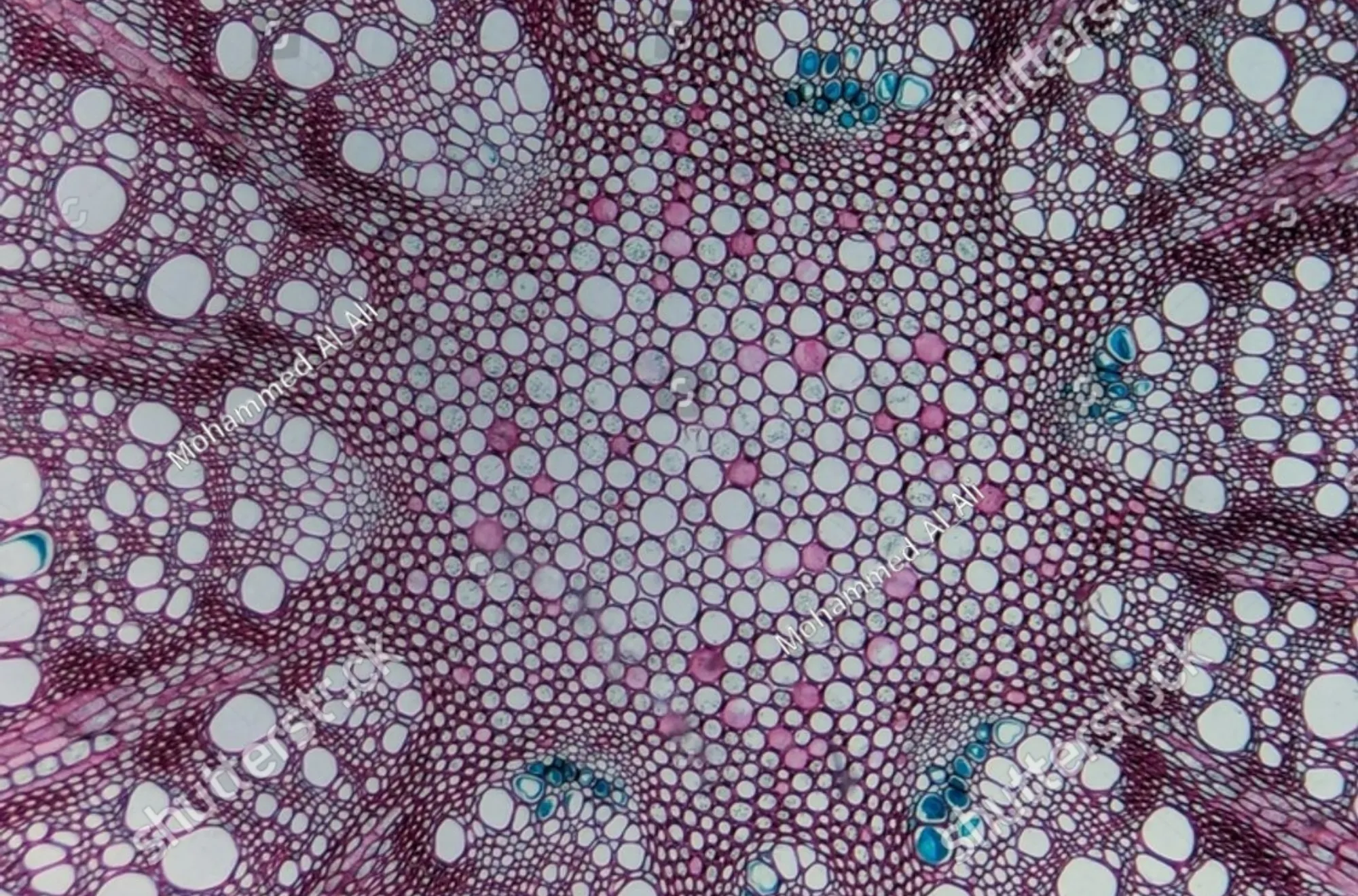 Rdi insight micrograph