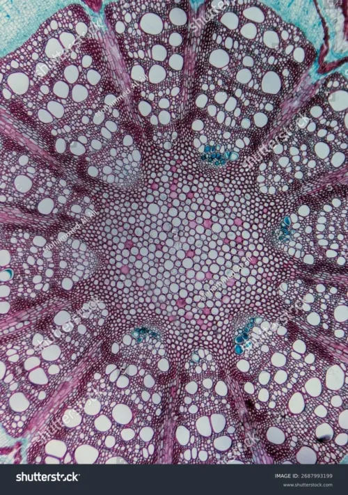 Rdi insight micrograph
